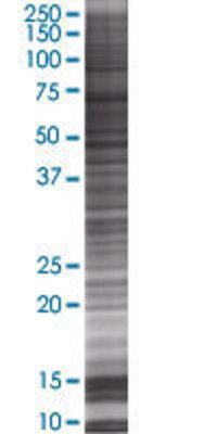 PFDN5 transfected lysate.