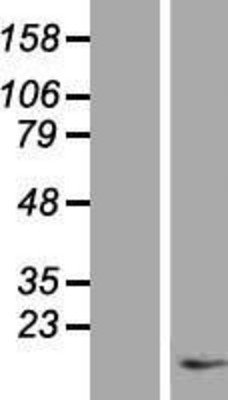 Western Blot: Substance P Overexpression Lysate (Adult Normal) [NBP2-10336] Left-Empty vector transfected control cell lysate (HEK293 cell lysate); Right -Over-expression Lysate for Substance P.