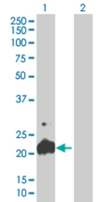 Lane 1: PFDN5 transfected lysate (17.05 KDa) Lane 2: Non-transfected lysate.