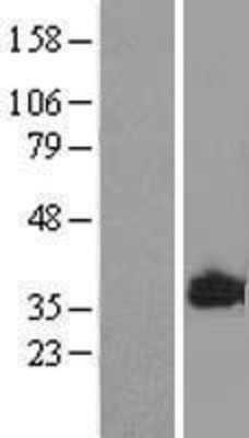Western Blot: MARCKS like protein Overexpression Lysate (Adult Normal) [NBL1-12896] Left-Empty vector transfected control cell lysate (HEK293 cell lysate); Right -Over-expression Lysate for MARCKS like protein.