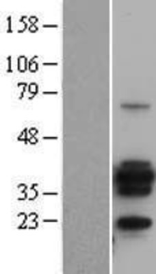 Western Blot: CD20 Overexpression Lysate (Adult Normal) [NBL1-13311] Left-Empty vector transfected control cell lysate (HEK293 cell lysate); Right -Over-expression Lysate for CD20.