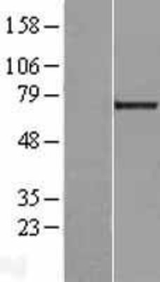 Western Blot: LGALS3BP Overexpression Lysate (Adult Normal) [NBL1-12502] Left-Empty vector transfected control cell lysate (HEK293 cell lysate); Right -Over-expression Lysate for LGALS3BP.