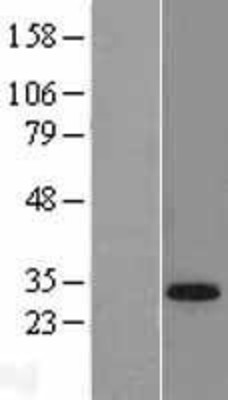 Western Blot: TGIF Overexpression Lysate (Adult Normal) [NBL1-16860] Left-Empty vector transfected control cell lysate (HEK293 cell lysate); Right -Over-expression Lysate for TGIF.