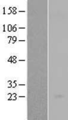 Western Blot: IL23 P19 Overexpression Lysate (Adult Normal) [NBL1-11943] Left-Empty vector transfected control cell lysate (HEK293 cell lysate); Right -Over-expression Lysate for IL23 P19.