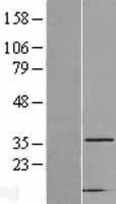 Western Blot: CAPZA2 Overexpression Lysate (Adult Normal) [NBL1-08691] Left-Empty vector transfected control cell lysate (HEK293 cell lysate); Right -Over-expression Lysate for CAPZA2.