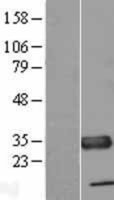 Western Blot: TXNDC Overexpression Lysate (Adult Normal) [NBL1-17463] Left-Empty vector transfected control cell lysate (HEK293 cell lysate); Right -Over-expression Lysate for TXNDC.