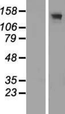 Western Blot: Adenylate Cyclase 3 Overexpression Lysate (Adult Normal) [NBP2-10559] Left-Empty vector transfected control cell lysate (HEK293 cell lysate); Right -Over-expression Lysate for Adenylate Cyclase 3.