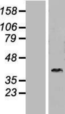Western Blot: DNAJB6 Overexpression Lysate (Adult Normal) [NBL1-09940] Left-Empty vector transfected control cell lysate (HEK293 cell lysate); Right -Over-expression Lysate for DNAJB6.