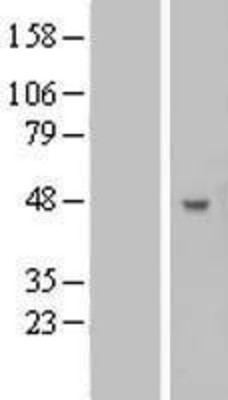 Western Blot: B3GNT5 Overexpression Lysate (Adult Normal) [NBL1-07887] Left-Empty vector transfected control cell lysate (HEK293 cell lysate); Right -Over-expression Lysate for B3GNT5.