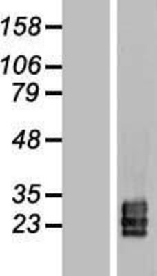 Western Blot: Tetraspanin-9 Overexpression Lysate (Adult Normal) [NBL1-17383] Left-Empty vector transfected control cell lysate (HEK293 cell lysate); Right -Over-expression Lysate for Tetraspanin-9.