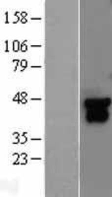 Western Blot: MEK4 Overexpression Lysate (Adult Normal) [NBL1-12850] Left-Empty vector transfected control cell lysate (HEK293 cell lysate); Right -Over-expression Lysate for MEK4.