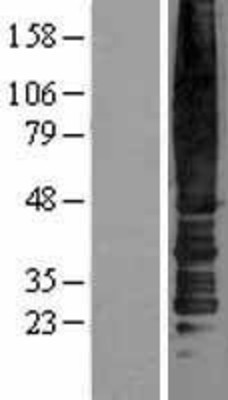 Western Blot: Chemokine Receptor D6 Overexpression Lysate (Adult Normal) [NBL1-08759] Left-Empty vector transfected control cell lysate (HEK293 cell lysate); Right -Over-expression Lysate for Chemokine Receptor D6.