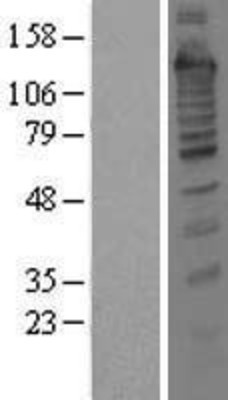 Western Blot: Treacher Collins syndrome protein Overexpression Lysate (Adult Normal) [NBL1-16785] Left-Empty vector transfected control cell lysate (HEK293 cell lysate); Right -Over-expression Lysate for Treacher Collins syndrome protein.