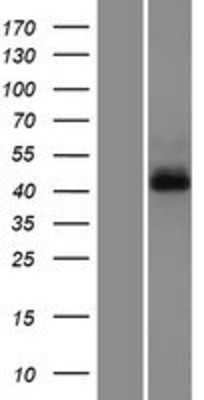 Western Blot: G protein alpha Overexpression Lysate (Adult Normal) [NBP2-10677] Left-Empty vector transfected control cell lysate (HEK293 cell lysate); Right -Over-expression Lysate for G protein alpha.