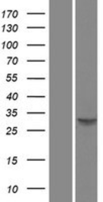 Western Blot: PU.1/Spi1 Overexpression Lysate (Adult Normal) [NBP2-10658] Left-Empty vector transfected control cell lysate (HEK293 cell lysate); Right -Over-expression Lysate for PU.1/Spi1.