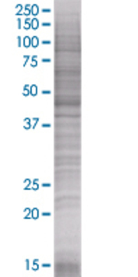 MAPK8 transfected lysate