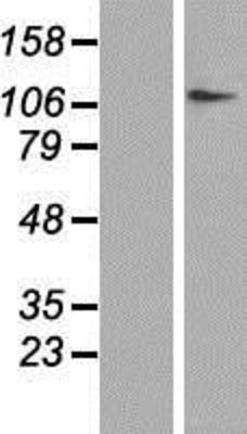 Western Blot: DPYD Overexpression Lysate (Adult Normal) [NBP2-09055] Left-Empty vector transfected control cell lysate (HEK293 cell lysate); Right -Over-expression Lysate for DPYD.