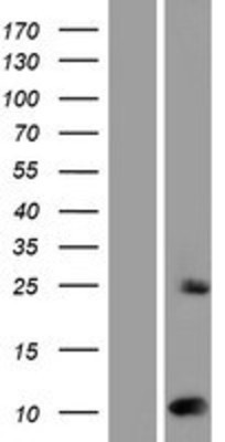 Western Blot: Sumo 2 Overexpression Lysate (Adult Normal) [NBP2-10389] Left-Empty vector transfected control cell lysate (HEK293 cell lysate); Right -Over-expression Lysate for Sumo 2.