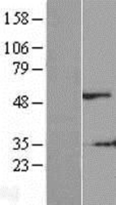 Western Blot: DSS1 Overexpression Lysate (Adult Normal) [NBP2-10419] Left-Empty vector transfected control cell lysate (HEK293 cell lysate); Right -Over-expression Lysate for DSS1.