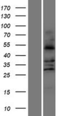 Western Blot: FALDH Overexpression Lysate (Adult Normal) [NBP2-10666] Left-Empty vector transfected control cell lysate (HEK293 cell lysate); Right -Over-expression Lysate for FALDH.