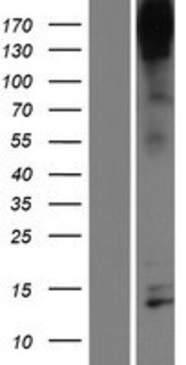 Western Blot: Nephrin Overexpression Lysate (Adult Normal) [NBP2-10533] Left-Empty vector transfected control cell lysate (HEK293 cell lysate); Right -Over-expression Lysate for Nephrin.