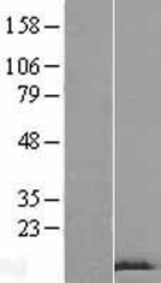 Western Blot: GnRH Overexpression Lysate (Adult Normal) [NBP2-10657] Left-Empty vector transfected control cell lysate (HEK293 cell lysate); Right -Over-expression Lysate for GnRH.