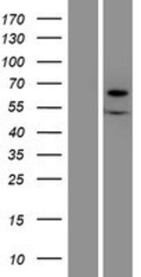 Western Blot: Xylulose kinase Overexpression Lysate (Adult Normal) [NBP2-10523] Left-Empty vector transfected control cell lysate (HEK293 cell lysate); Right -Over-expression Lysate for Xylulose kinase.