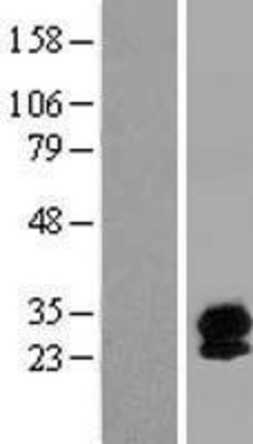 Western Blot: Synaptogyrin 4 Overexpression Lysate (Adult Normal) [NBP2-10351] Left-Empty vector transfected control cell lysate (HEK293 cell lysate); Right -Over-expression Lysate for Synaptogyrin 4.