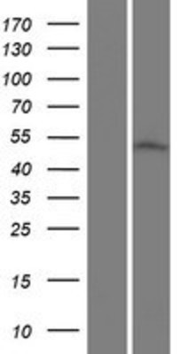 Western Blot: CGI-16 Overexpression Lysate (Adult Normal) [NBP2-10620] Left-Empty vector transfected control cell lysate (HEK293 cell lysate); Right -Over-expression Lysate for CGI-16.