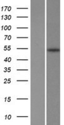 Western Blot: Fatty acid desaturase 2 Overexpression Lysate (Adult Normal) [NBP2-10570] Left-Empty vector transfected control cell lysate (HEK293 cell lysate); Right -Over-expression Lysate for Fatty acid desaturase 2.
