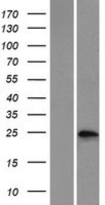 Western Blot: Phosphoserine phosphatase Overexpression Lysate (Adult Normal) [NBP2-10531] Left-Empty vector transfected control cell lysate (HEK293 cell lysate); Right -Over-expression Lysate for Phosphoserine phosphatase.