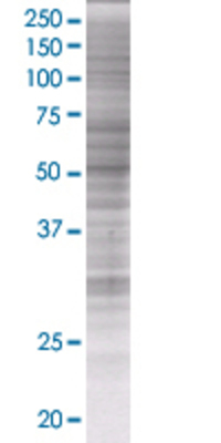 NFIX transfected lysate.