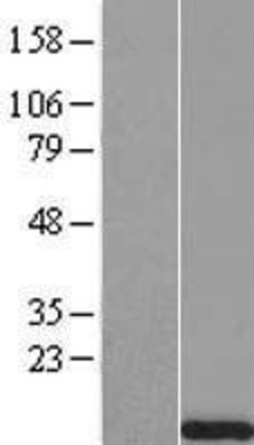 Western Blot: Uroguanylin Overexpression Lysate (Adult Normal) [NBP2-10385] Left-Empty vector transfected control cell lysate (HEK293 cell lysate); Right -Over-expression Lysate for Uroguanylin.