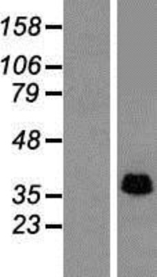 Western Blot: SLP-2 Overexpression Lysate (Adult Normal) [NBP2-10338] Left-Empty vector transfected control cell lysate (HEK293 cell lysate); Right -Over-expression Lysate for SLP-2.