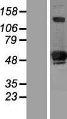 Western Blot: SIVA Overexpression Lysate (Adult Normal) [NBP2-10413] Left-Empty vector transfected control cell lysate (HEK293 cell lysate); Right -Over-expression Lysate for SIVA.