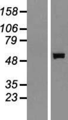 Western Blot: Salivary Amylase Alpha Overexpression Lysate (Adult Normal) [NBP2-10560] Left-Empty vector transfected control cell lysate (HEK293 cell lysate); Right -Over-expression Lysate for Salivary Amylase Alpha.