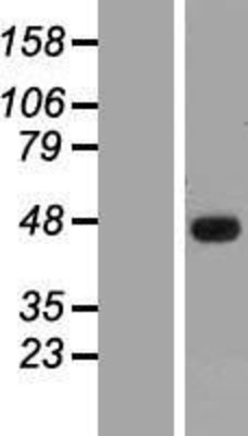 Western Blot: SSBP3 Overexpression Lysate (Adult Normal) [NBL1-16467] Left-Empty vector transfected control cell lysate (HEK293 cell lysate); Right -Over-expression Lysate for SSBP3.