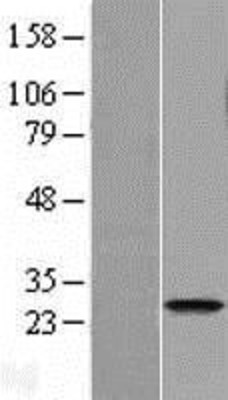 Western Blot: FAM119A Overexpression Lysate (Adult Normal) [NBL1-10454] Left-Empty vector transfected control cell lysate (HEK293 cell lysate); Right -Over-expression Lysate for FAM119A.