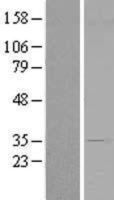 Western Blot: CENPV Overexpression Lysate (Adult Normal) [NBL1-14835] Left-Empty vector transfected control cell lysate (HEK293 cell lysate); Right -Over-expression Lysate for CENPV.