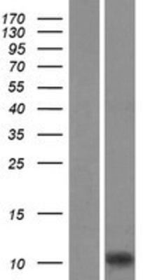 Western Blot: Iba1 Overexpression Lysate (Adult Normal) [NBL1-07408] Left-Empty vector transfected control cell lysate (HEK293 cell lysate); Right -Over-expression Lysate for Iba1.