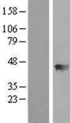 Western Blot: BBOX1 Overexpression Lysate (Adult Normal) [NBL1-07926] Left-Empty vector transfected control cell lysate (HEK293 cell lysate); Right -Over-expression Lysate for BBOX1.