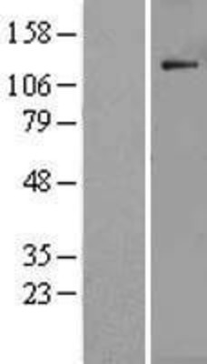 Western Blot: POLR1B Overexpression Lysate (Adult Normal) [NBL1-14574] Left-Empty vector transfected control cell lysate (HEK293 cell lysate); Right -Over-expression Lysate for POLR1B.