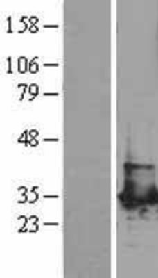 Western Blot: PGAM1 Overexpression Lysate (Adult Normal) [NBL1-14323] Left-Empty vector transfected control cell lysate (HEK293 cell lysate); Right -Over-expression Lysate for PGAM1.