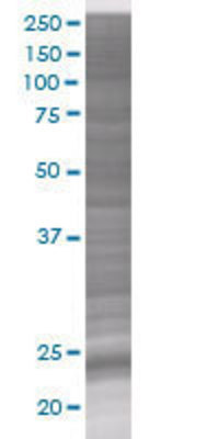 DTYMK transfected lysate.