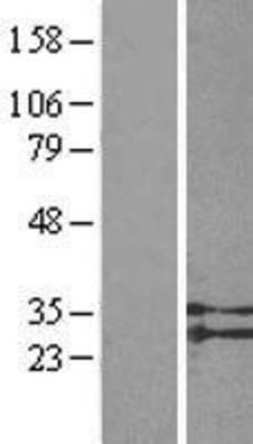 Western Blot: GPR91 Overexpression Lysate (Adult Normal) [NBL1-16595] Left-Empty vector transfected control cell lysate (HEK293 cell lysate); Right -Over-expression Lysate for GPR91.