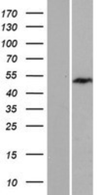 Western Blot: Exosome Component 9 Overexpression Lysate (Adult Normal) [NBP2-10617] Left-Empty vector transfected control cell lysate (HEK293 cell lysate); Right -Over-expression Lysate for Exosome Component 9.