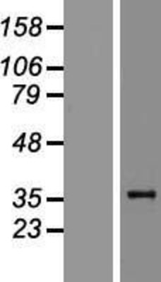 Western Blot: Zhangfei Overexpression Lysate (Adult Normal) [NBP2-10610] Left-Empty vector transfected control cell lysate (HEK293 cell lysate); Right -Over-expression Lysate for Zhangfei.