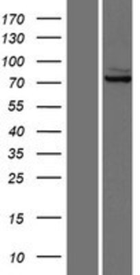 Western Blot: Glutaminase Overexpression Lysate (Adult Normal) [NBP2-10302] Left-Empty vector transfected control cell lysate (HEK293 cell lysate); Right -Over-expression Lysate for Glutaminase.