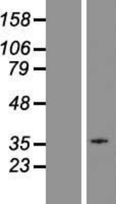 Western Blot: GPR18 Overexpression Lysate (Adult Normal) [NBP2-10475] Left-Empty vector transfected control cell lysate (HEK293 cell lysate); Right -Over-expression Lysate for GPR18.