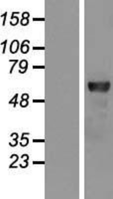 Western Blot: Rel B Overexpression Lysate (Adult Normal) [NBP2-10407] Left-Empty vector transfected control cell lysate (HEK293 cell lysate); Right -Over-expression Lysate for Rel B.